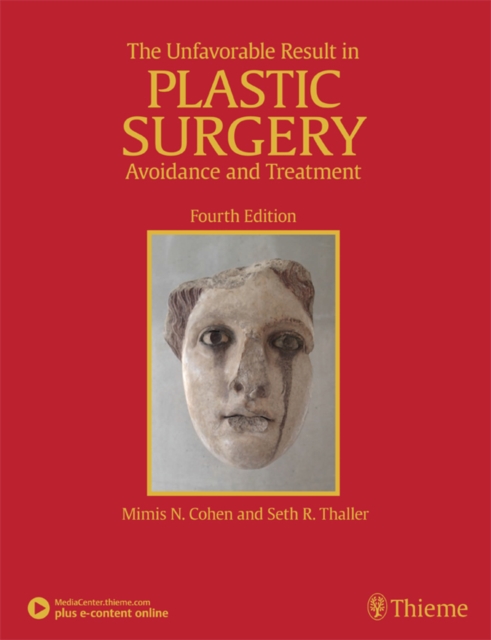 The Unfavorable Result in Plastic Surgery : Avoidance and Treatment, EPUB eBook