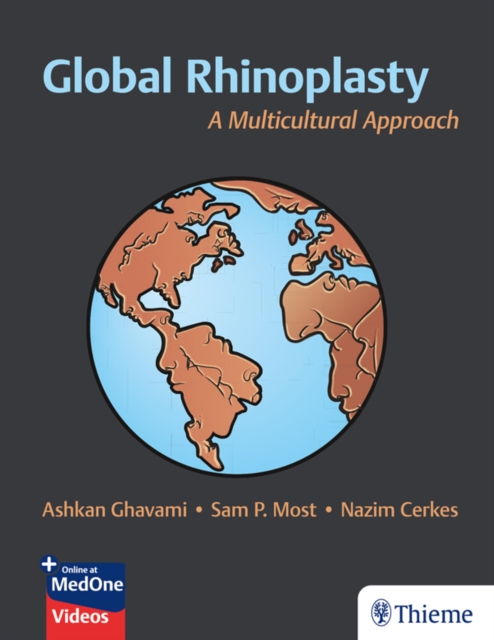 Global Rhinoplasty : A Multicultural Approach, EPUB eBook