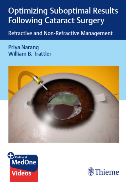 Optimizing Suboptimal Results Following Cataract Surgery : Refractive and Non-Refractive Management, EPUB eBook