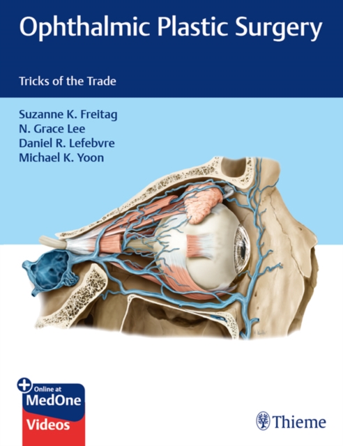 Ophthalmic Plastic Surgery : Tricks of the Trade, EPUB eBook
