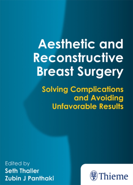 Aesthetic and Reconstructive Breast Surgery : Solving Complications and Avoiding Unfavorable Results, EPUB eBook