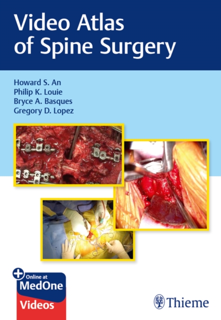 Video Atlas of Spine Surgery, EPUB eBook