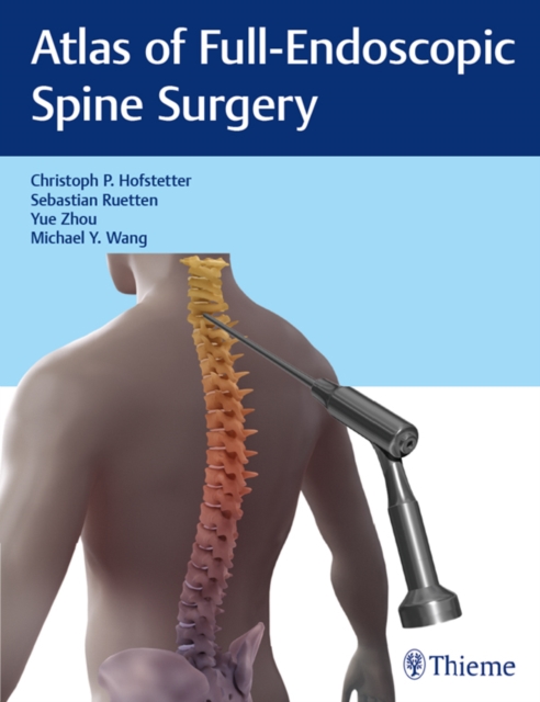 Atlas of Full-Endoscopic Spine Surgery, EPUB eBook