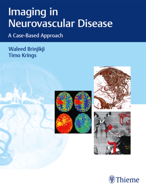 Imaging in Neurovascular Disease : A Case-Based Approach, EPUB eBook