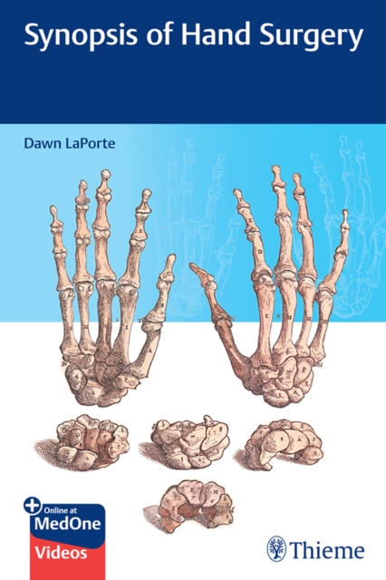 Synopsis of Hand Surgery, EPUB eBook