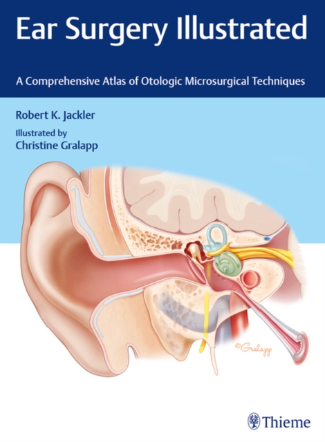 Ear Surgery Illustrated : A Comprehensive Atlas of Otologic Microsurgical Techniques, EPUB eBook