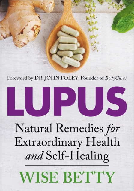 Lupus : Natural Remedies for Extraordinary Health and Self-Healing, EPUB eBook