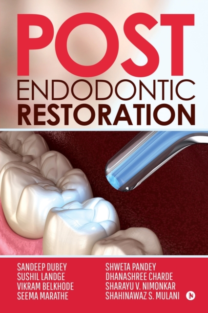 Post Endodontic Restoration, Paperback / softback Book