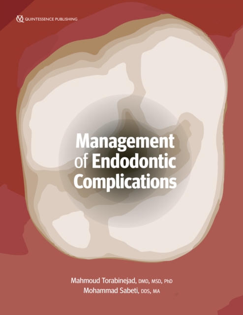 Management of Endodontic Complications : From Diagnosis to Prognosis, EPUB eBook