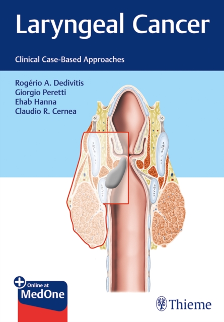 Laryngeal Cancer : Clinical Case-Based Approaches, Mixed media product Book