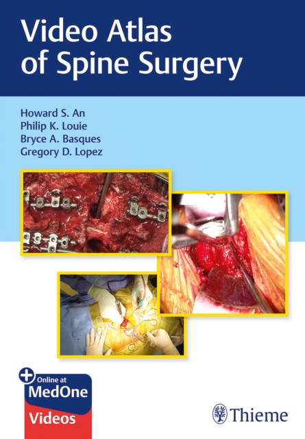 Video Atlas of Spine Surgery, Multiple-component retail product, part(s) enclose Book