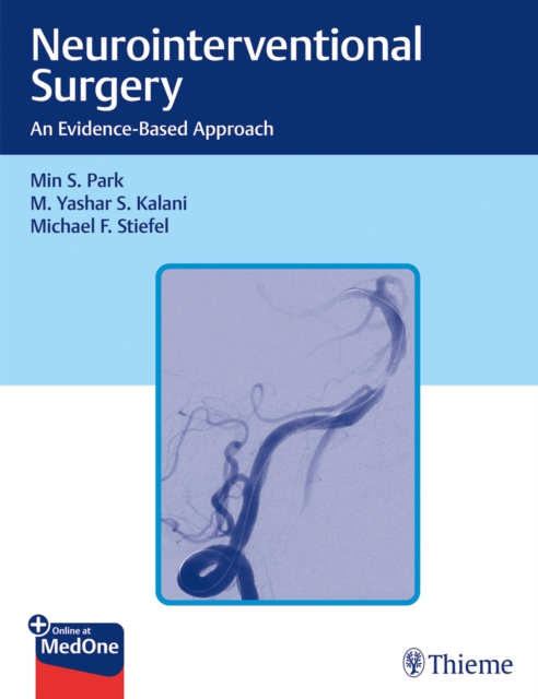 Neurointerventional Surgery : An Evidence-Based Approach, Multiple-component retail product, part(s) enclose Book