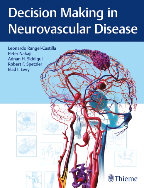 Decision Making in Neurovascular Disease, Hardback Book