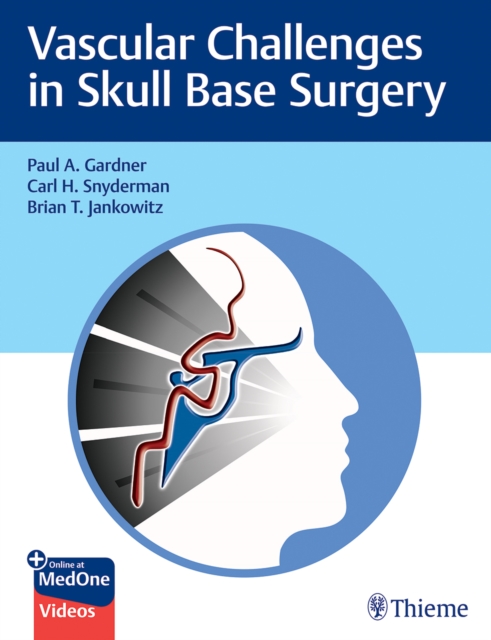 Vascular Challenges in Skull Base Surgery, Mixed media product Book