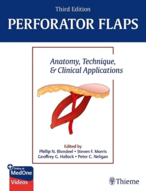 Perforator Flaps : Anatomy, Technique, & Clinical Applications, Hardback Book