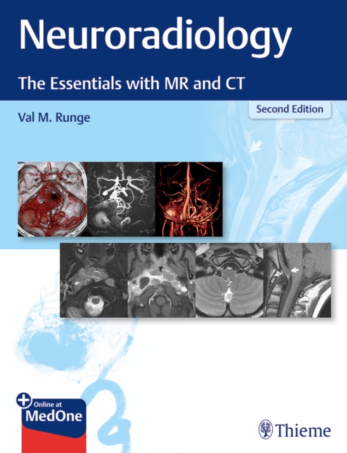 Neuroradiology : The Essentials with MR and CT, Multiple-component retail product, part(s) enclose Book