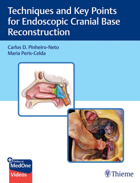 Techniques and Key Points for Endoscopic Cranial Base Reconstruction, Mixed media product Book