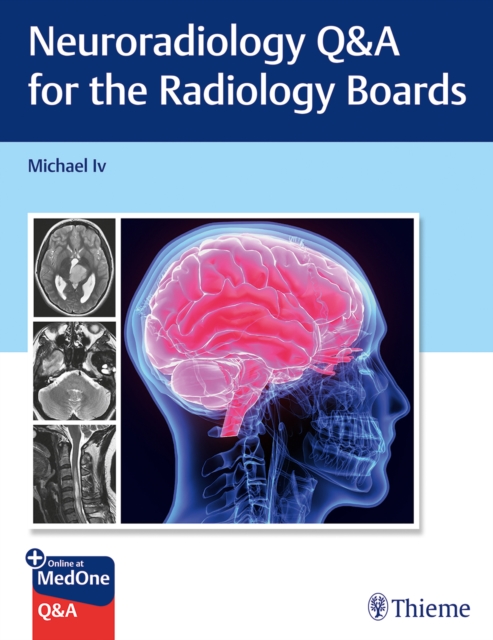 Neuroradiology Q&A for the Radiology Boards, Paperback / softback Book