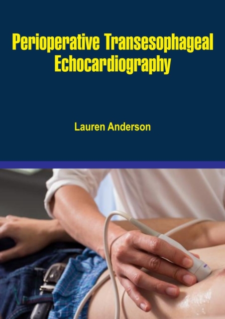 Perioperative Transesophageal Echocardiography, EPUB eBook