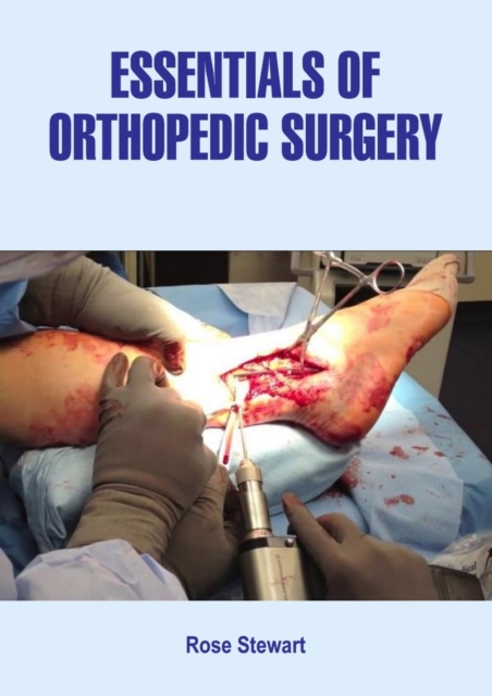 Essentials of Orthopedic Surgery, EPUB eBook