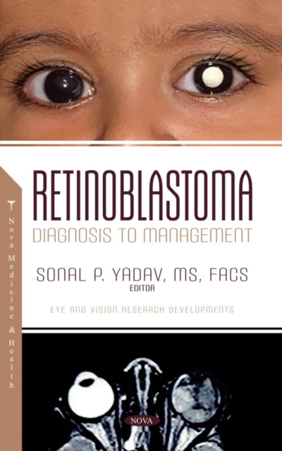 Retinoblastoma: Diagnosis to Management, Hardback Book