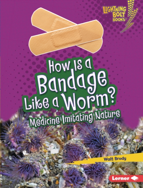 How Is a Bandage Like a Worm? : Medicine Imitating Nature, EPUB eBook