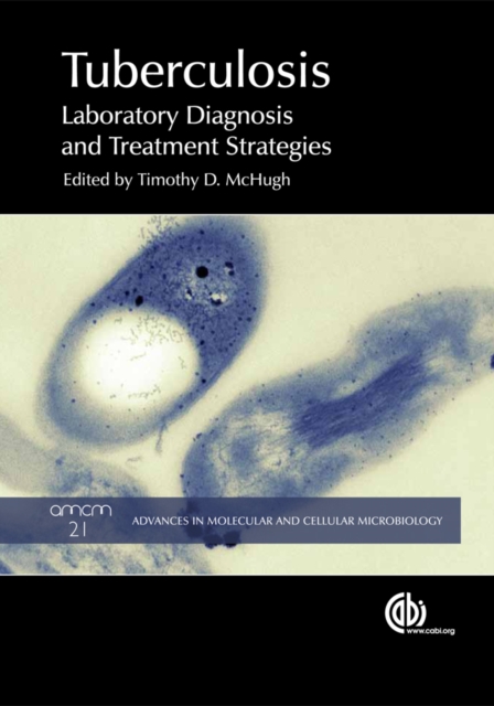 Tuberculosis : Laboratory Diagnosis and Treatment Strategies, PDF eBook