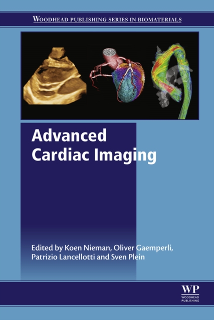 Advanced Cardiac Imaging, EPUB eBook