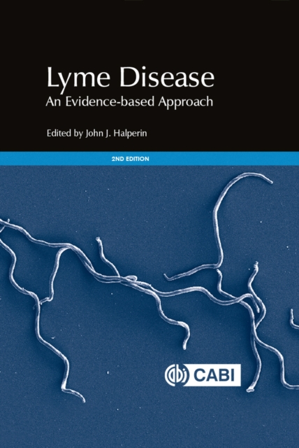 Lyme Disease : An Evidence-based Approach, Hardback Book