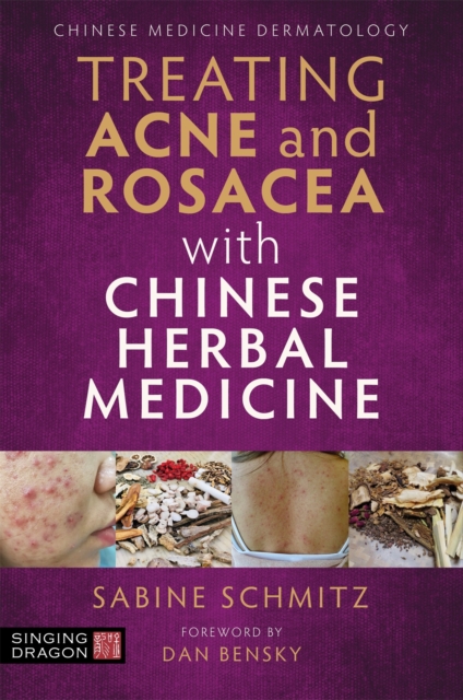 Treating Acne and Rosacea with Chinese Herbal Medicine, Paperback / softback Book