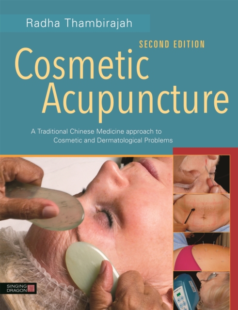 Cosmetic Acupuncture, Second Edition : A Traditional Chinese Medicine Approach to Cosmetic and Dermatological Problems, Paperback / softback Book