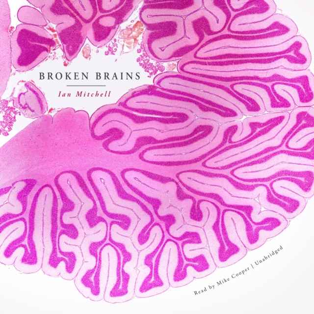 Broken Brains, eAudiobook MP3 eaudioBook