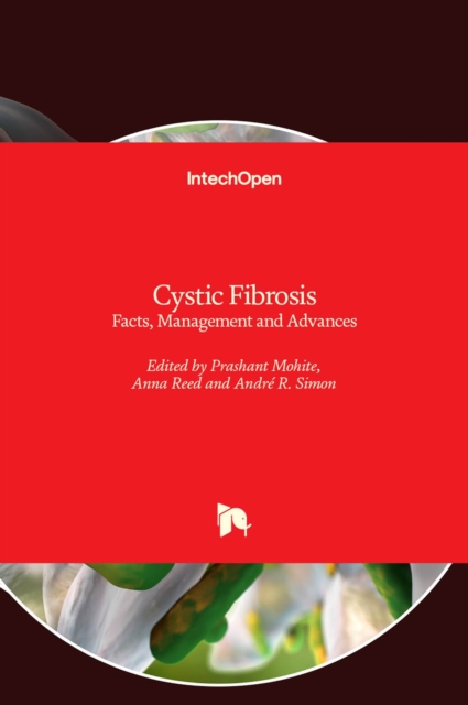 Cystic Fibrosis : Facts, Management and Advances, Hardback Book