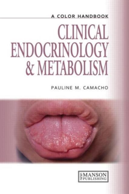 Clinical Endocrinology and Metabolism, Paperback / softback Book