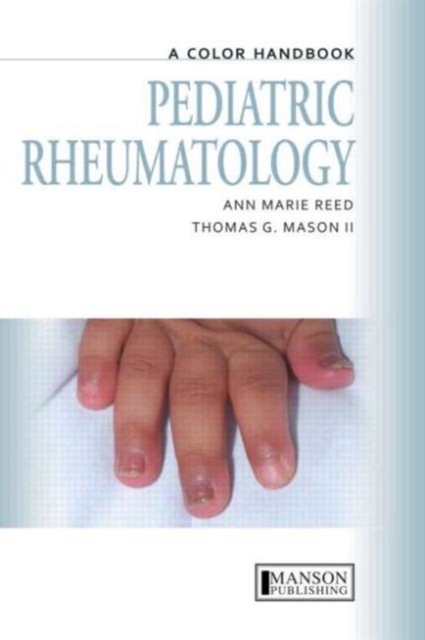 Pediatric Rheumatology : A Color Handbook, Paperback / softback Book