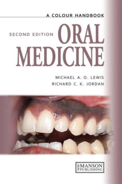 Oral Medicine, Paperback Book