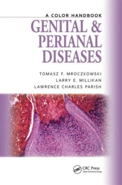 Genital and Perianal Diseases : A Color Handbook, Paperback / softback Book