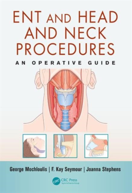 ENT and Head and Neck Procedures : An Operative Guide, Paperback / softback Book