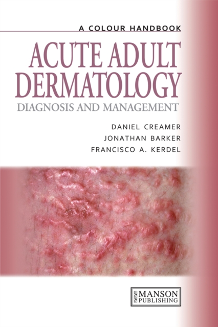 Acute Adult Dermatology : Diagnosis and Management: A Colour Handbook, EPUB eBook