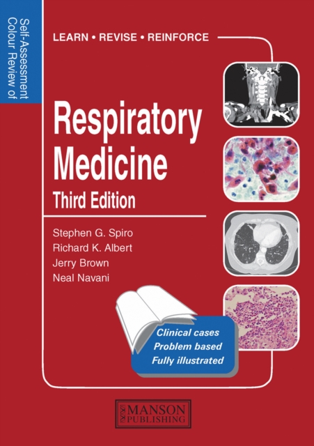 Respiratory Medicine : Self-Assessment Colour Review, Third Edition, EPUB eBook