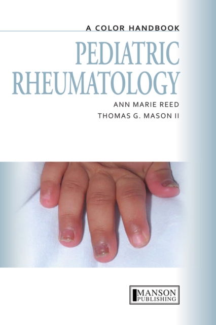 Pediatric Rheumatology : A Color Handbook, EPUB eBook