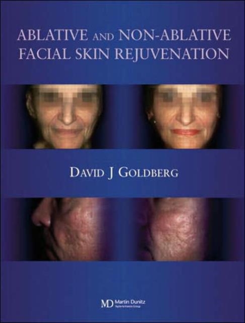 Ablative and Non-ablative Facial Skin Rejuvenation, Hardback Book
