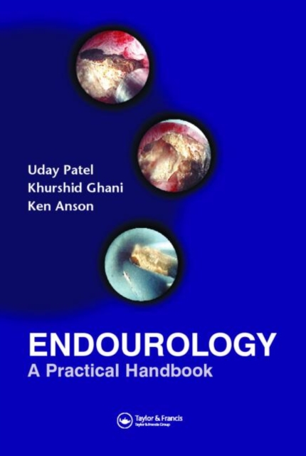 Endourology : A Practical Handbook, Paperback / softback Book