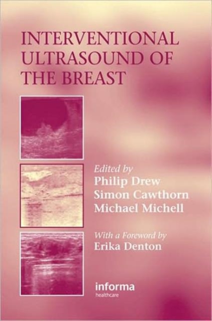 Interventional Ultrasound of the Breast, Hardback Book