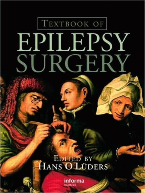 Textbook of Epilepsy Surgery, Hardback Book