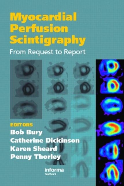 Myocardial Perfusion Scintigraphy : From Request to Report, Hardback Book