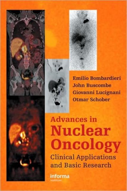 Advances in Nuclear Oncology: : Diagnosis and Therapy, Hardback Book