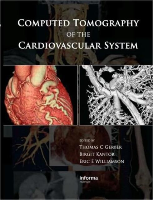 Computed Tomography of the Cardiovascular System, Hardback Book