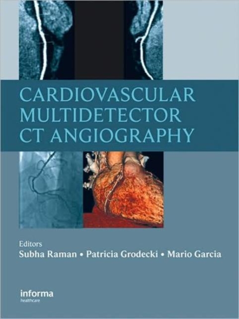 Cardiovascular Multidetector CT Angiography, Hardback Book