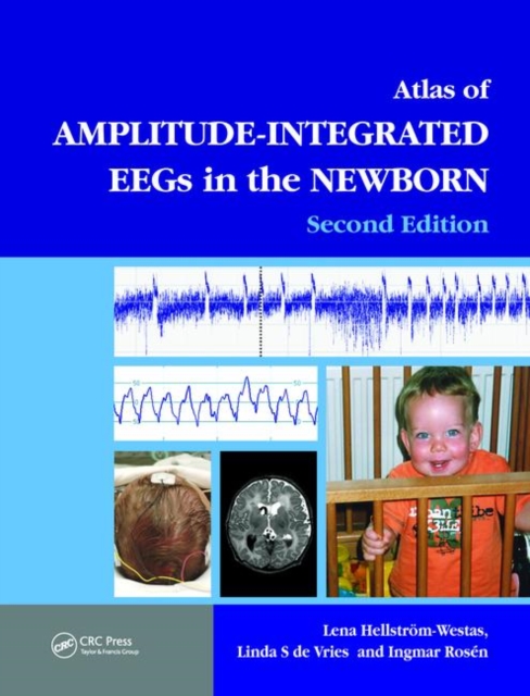 An Atlas of Amplitude-Integrated EEGs in the Newborn, Hardback Book